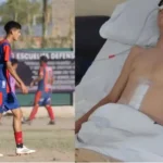 Buenas noticias para Lucas Díaz: el jugador de Villa Obrera evoluciona tras su segunda operación